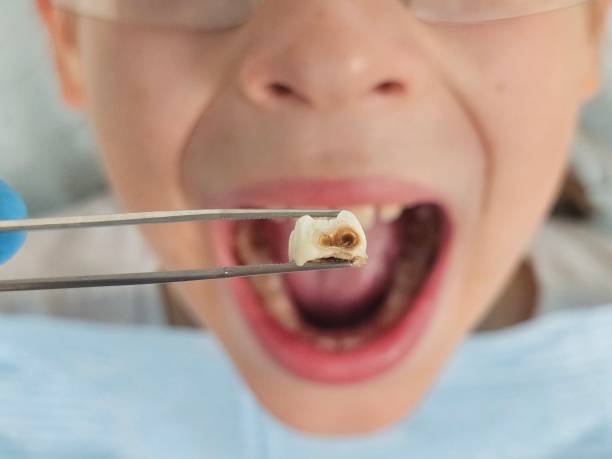 Best Tooth Pain Emergency Relief  in Eddyville, KY